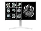 LG 27" 27HJ712C-W Clinical UHD 4K 2xHDMI DP IPS 16:09