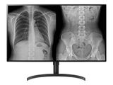 LG 32" 32HL512D-B Diagnose TFT 2xDP,HDMI,USB 3.0